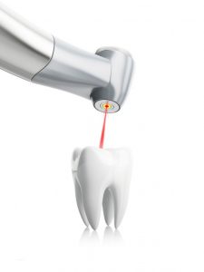 terapie laser dentali torino